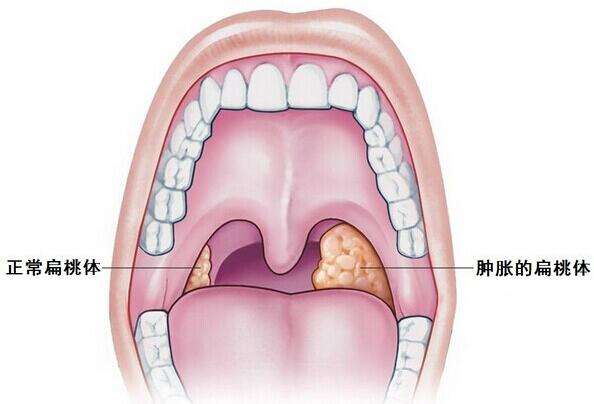 再见了,那些年口臭给我带来的尴尬