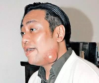 “世纪大毒疮”罗兆辉:少年得志拥有一切,47岁死时已经无人理