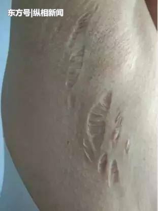 女医生发文举报前夫“毒杀”妻子,男方称前妻“诬告”